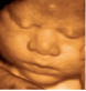 Teaser | Leistung | Schwangerschaftsvorsorge | 3+4D Ultraschall